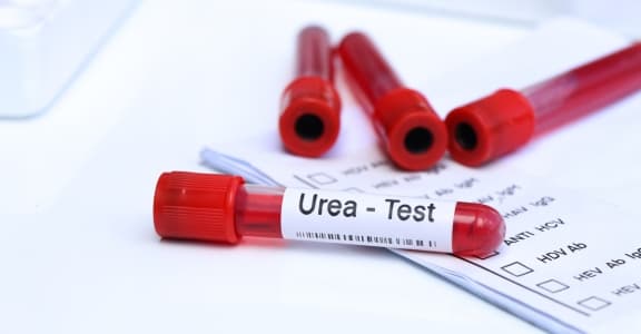 Blood Urea Nitrogen (BUN) – Complete Patient Guide