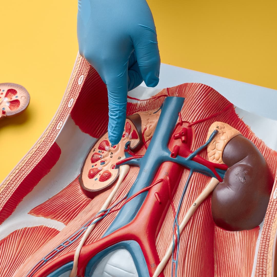 Kidney Stones & Urinary Disorders