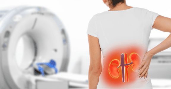 7 Warning Signs of Kidney Disease | How to Know If Your Kidneys Are Failing?