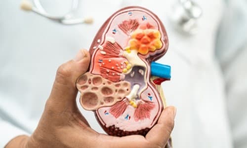 Understanding Chronic Kidney Disease (CKD)