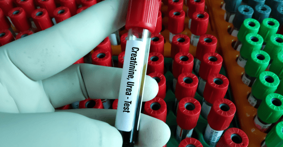 Creatinine levels before and after dialysis