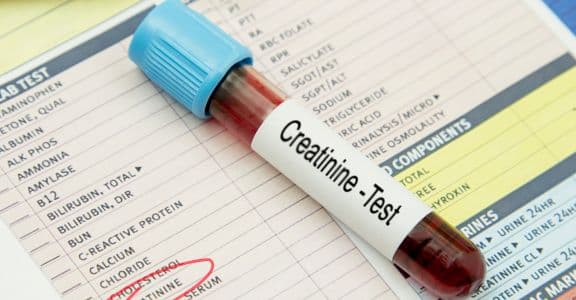 Understanding Creatinine Levels
