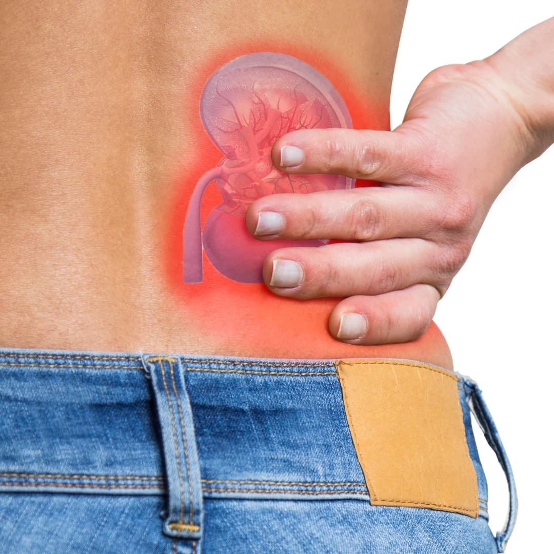 Kidney Stones & Urinary Disorders