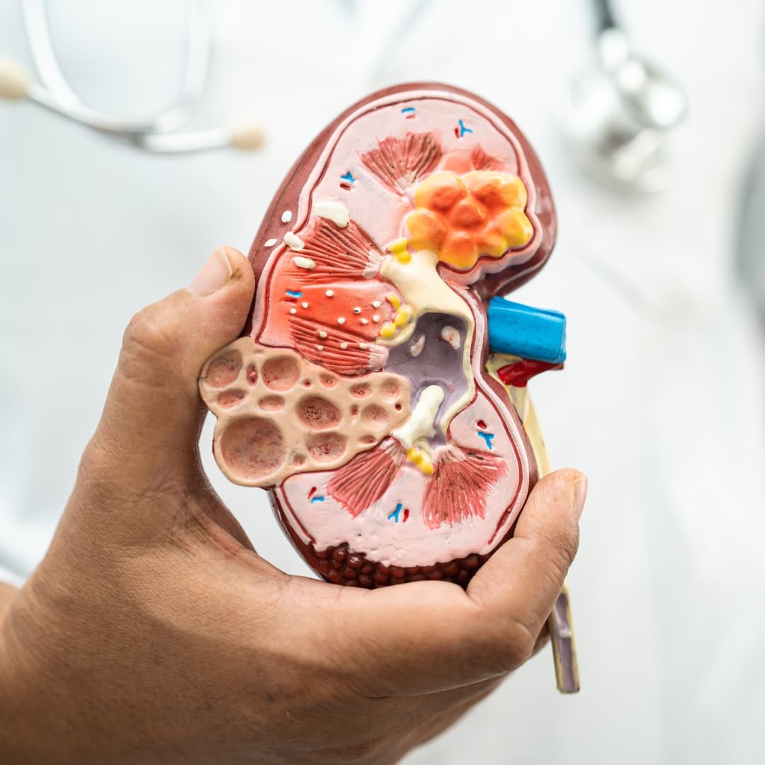 Kidney Stones & Urinary Disorders