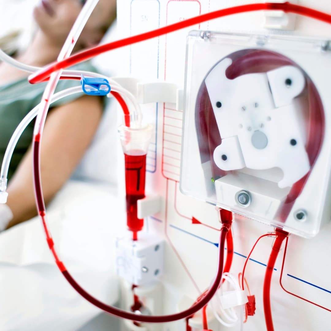 Kidney Stones & Urinary Disorders