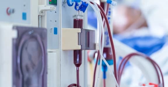 Dialysis Explained: Types, Procedure & How It Works